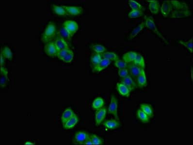 Polyclonal Rabbit anti-Human CD36 Antibody (IHC, IF, WB)