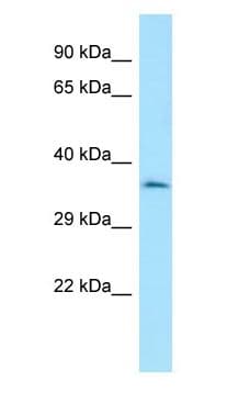 Polyclonal Rabbit anti-Human CENPO Antibody (aa21-70, WB)