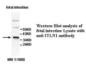IHC-plus™ ITLN1 / Omentin Antibody (aa27-168)