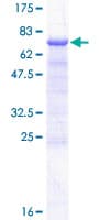 Human DLK2 Protein (Recombinant GST)
