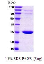 Human YWHAB / 14-3-3 Beta Protein (Recombinant)