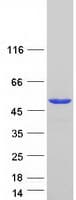 Human PUS1 Protein (Recombinant Myc-DDK (Flag))