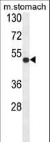 IHC-plus™ Polyclonal Rabbit anti-Human FERMT1 / Kindlin Antibody (aa268-297, IHC, WB)