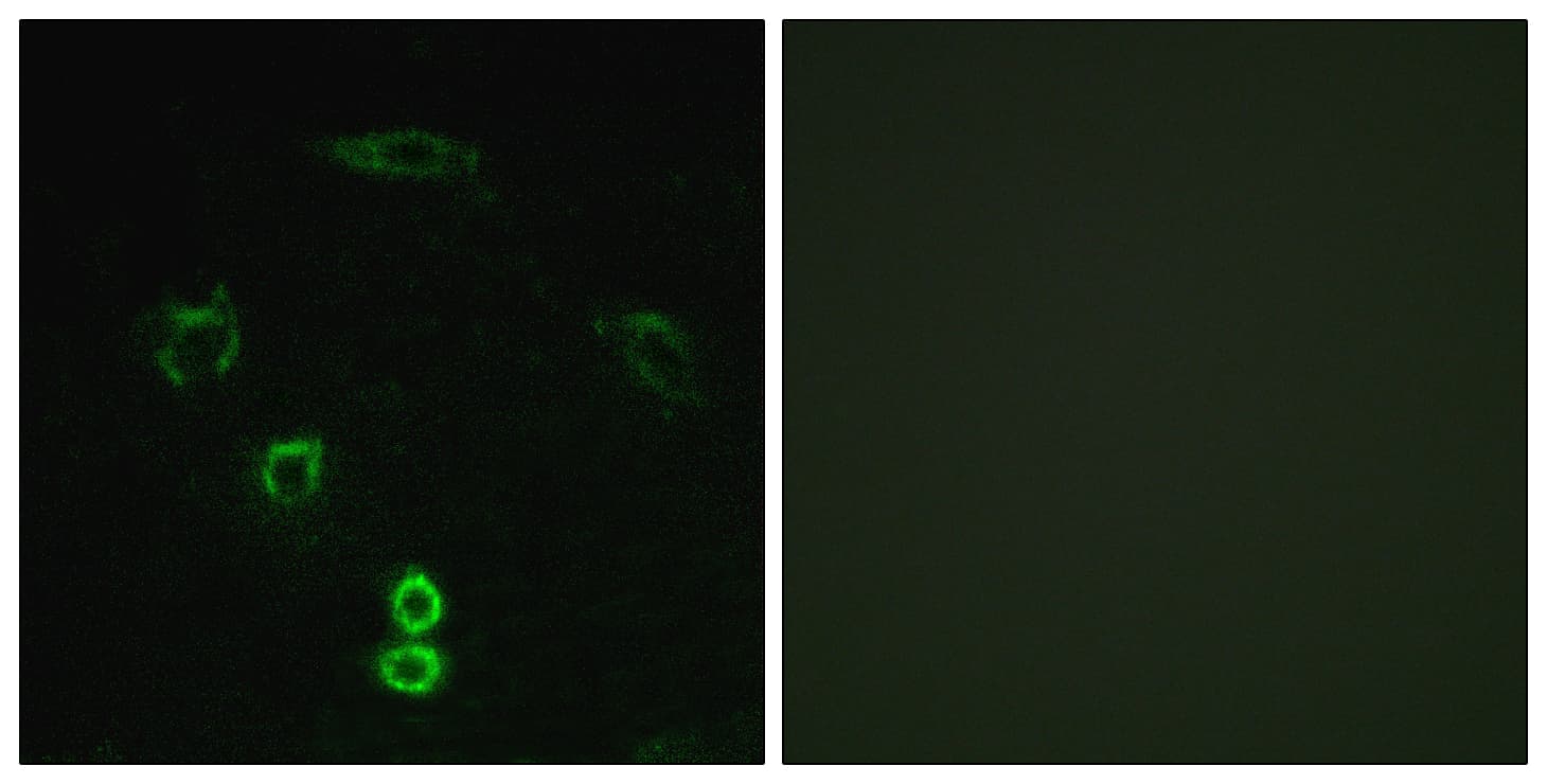 Polyclonal Rabbit anti-Human GLYCTK / Glycerate Kinase Antibody (aa101-150, IHC, IF, WB)