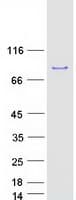 Human RIOK1 Protein (Recombinant Myc-DDK (Flag))