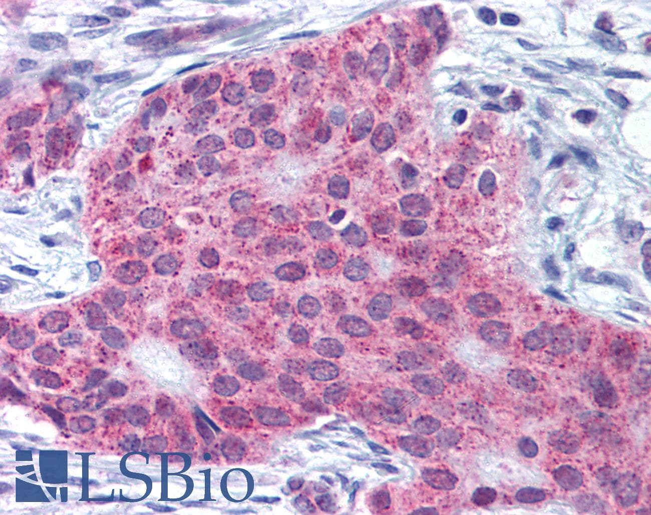 IHC-plus™ Polyclonal Rabbit anti-Human MMP13 Antibody (C-Terminus, IHC)