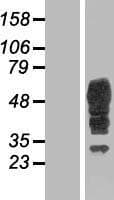VMD2L3 / BEST3 Protein (Over-Expression Lysate Myc-DDK (Flag))