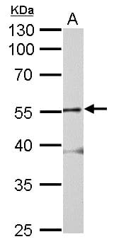 GLRA2 Antibody (aa1-216)
