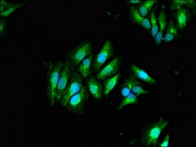 GLB1 / Beta-Galactosidase Antibody