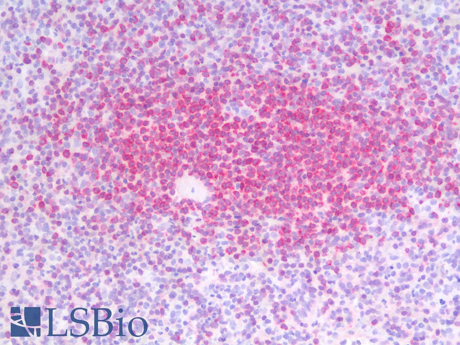 PathPlus™ BCL2 / Bcl-2 Antibody (clone BCL2/2210R)