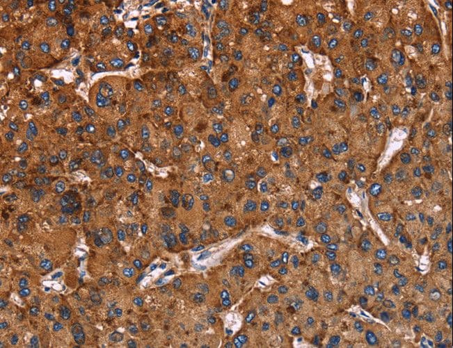 LAMP2 / CD107b Antibody