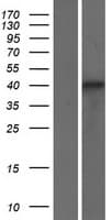 Human SRSF6 / SRP55 Protein (Over-Expression Lysate Myc-DDK (Flag))