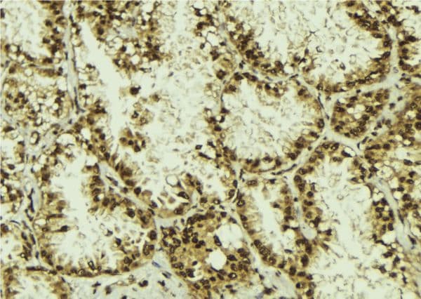Polyclonal Rabbit anti-Human DYX1C1 Antibody (IHC, IF, WB)