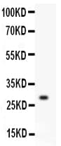 KLK1 / Kallikrein 1 Antibody (aa25-261)