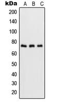 RELA / NFKB p65 Antibody (phospho-Ser536)