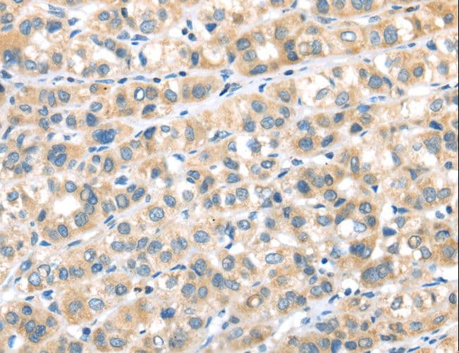 RIP4 / ANKRD3 Antibody