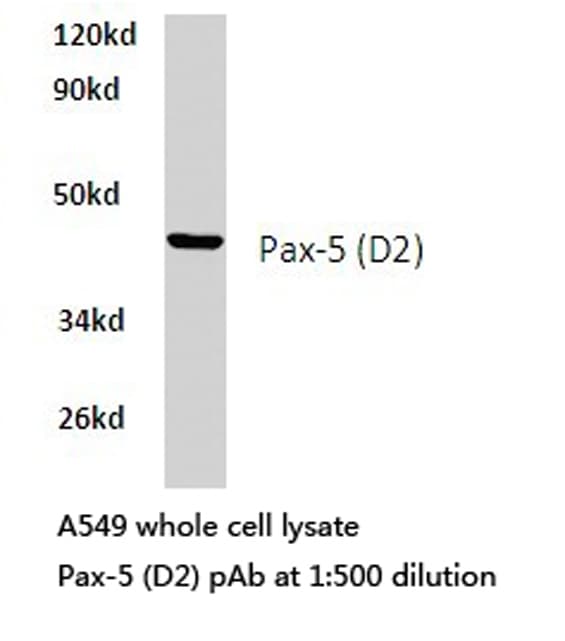 PAX5 Antibody (Asp2)