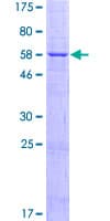 Human PARP16 Protein (Recombinant GST)