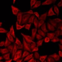 AHSG / Fetuin A Antibody