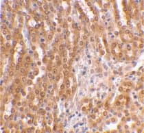 TICAM2 / TRAM Antibody