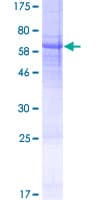 Human USP50 Protein (Recombinant GST)