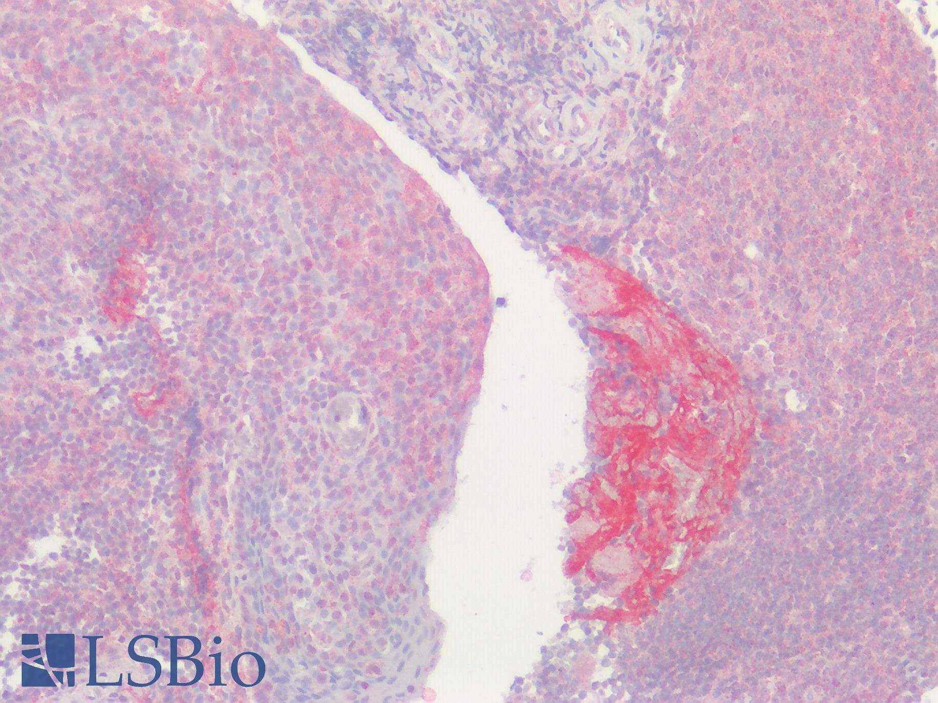 IHC-plus™ GPRC5D Antibody (Cytoplasmic Domain)