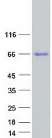 Human EBF4 Protein (Recombinant Myc-DDK (Flag))