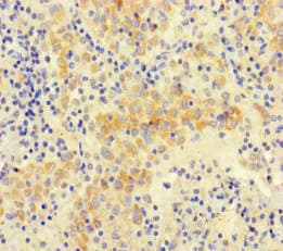 Polyclonal Rabbit anti-Human NGN / Neogenin Antibody (IHC, IF)