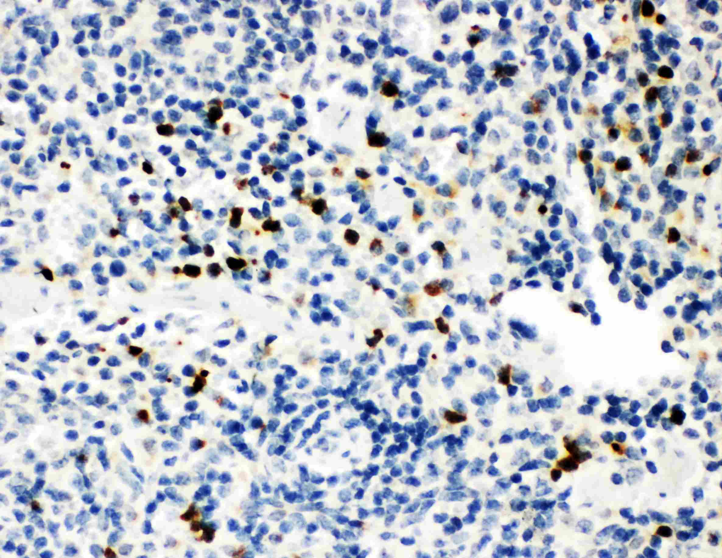 Polyclonal Rabbit anti-Human MPO / Myeloperoxidase Antibody (IHC, WB)