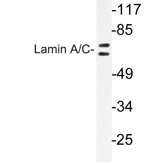 LMNA / Lamin A+C Antibody (Arg386)