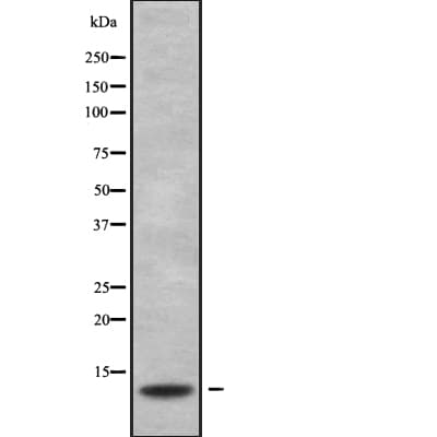 S100G / CABP9K Antibody