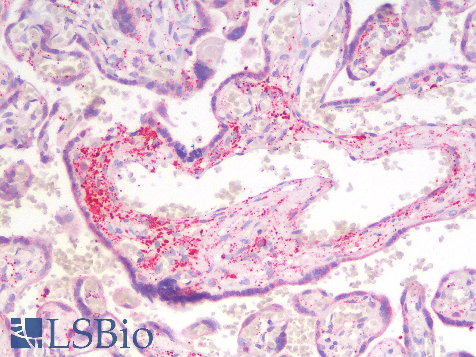 IHC-plus™ MMP2 Antibody