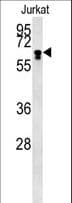IHC-plus™ BTBD9 Antibody (aa237-262)