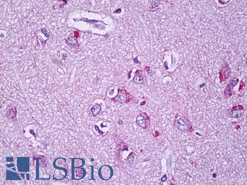 IHC-plus™ KCNJ9 / Kir3.3 / GIRK3 Antibody (aa61-110)