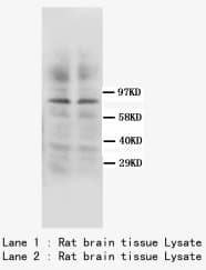 PRKCG / PKC-Gamma Antibody (C-Terminus)