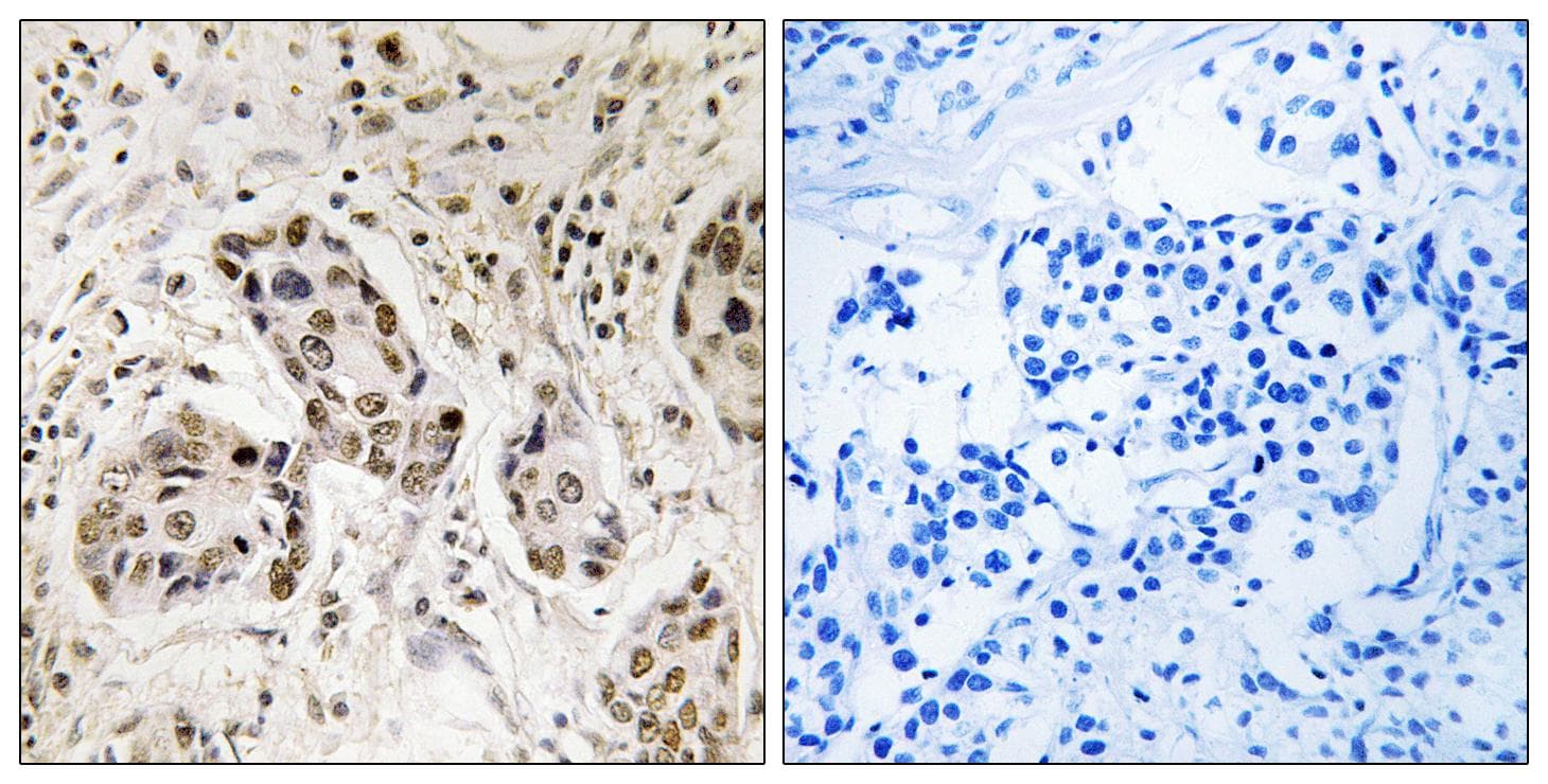 RCC2 Antibody