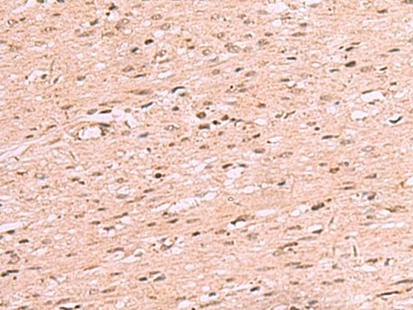 RRP8 Antibody