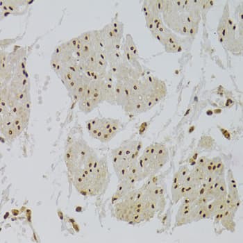 Polyclonal Rabbit anti-Human XRCC6 / Ku70 Antibody (IHC, IF, WB)
