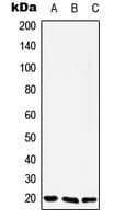 Polyclonal Rabbit anti-Human YAF2 Antibody (N-Terminus, WB)