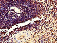 TMEM11 Antibody