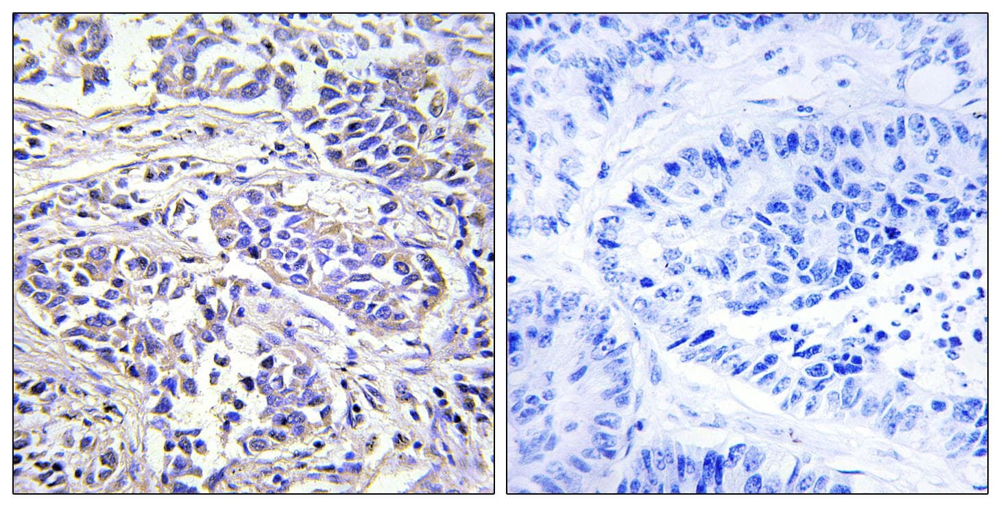 PLCXD1 Antibody