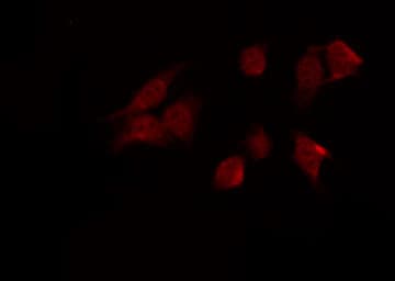 PRKAA1 / AMPK Alpha 1 Antibody