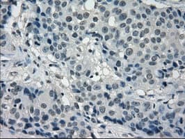 Monoclonal Mouse anti-Human FRK Antibody (clone OTI6D2, IHC, IF, WB)