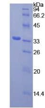 Mouse SYK Protein (Recombinant His-T7)