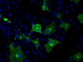 TLDC1 / KIAA1609 Antibody (clone OTI13H6)