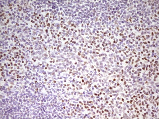 MEF2D Antibody (aa1-282, clone OTI1E11, Carrier-free)