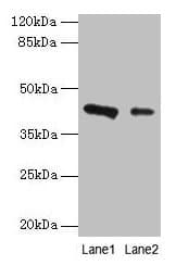 RAD23B / HR23B Antibody