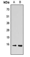 Polyclonal Rabbit anti-Human PEA15 / PEA-15 Antibody (Internal, IHC, WB)
