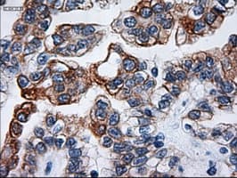 KRT18 / CK18 / Cytokeratin 18 Antibody (clone OTI1E1)