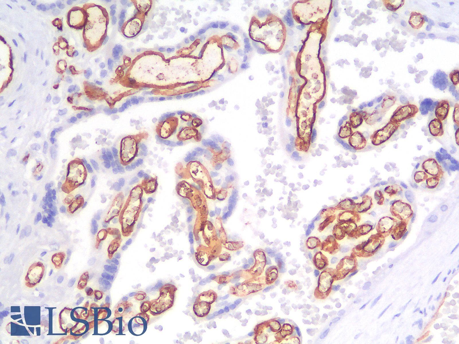 PathPlus™ Recombinant Monoclonal Rabbit anti-Human CD34 Antibody (clone HPCA1/2598R, IHC)